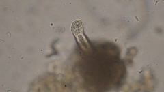 Gastrotricha