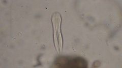 Gastrotricha