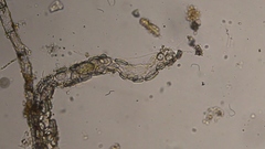 Cocconeis