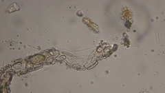 Cocconeis