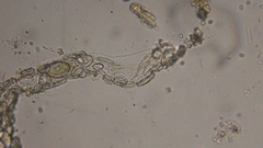 Cocconeis