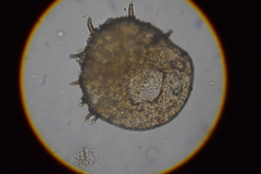 Centropyxis aculeata