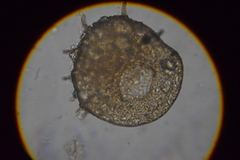 Centropyxis aculeata