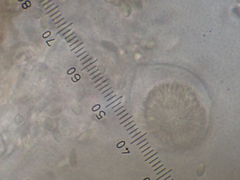 Protubera parvispora