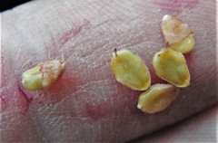 Cotoneaster vestitus