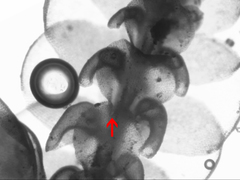 Frullania falciloba