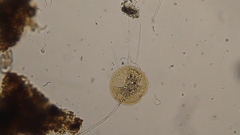 Arcella vulgaris