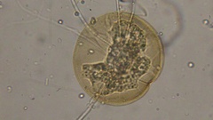 Arcella vulgaris