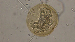 Arcella vulgaris