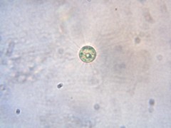 Golenkinia
