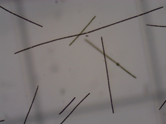 Dolichospermum planctonicum