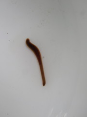 Erpobdellidae