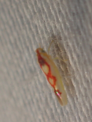 Zygina flammigera