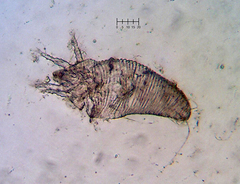 Eriophyes rhoinus