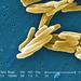 Bacteria de la Tuberculosis - Photo Public Health Image Library, sin restricciones conocidas de derechos (dominio público)