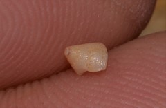 Calliostomatidae