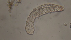 Gastrotricha