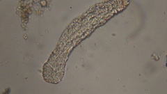 Gastrotricha