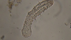 Gastrotricha