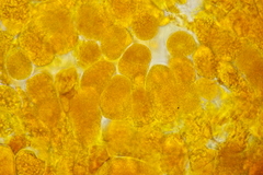 Coleosporium tussilaginis