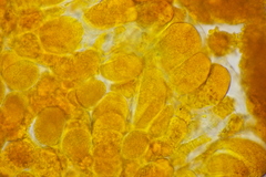 Coleosporium tussilaginis