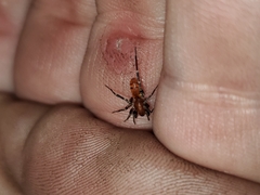 Castianeira alteranda