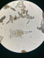 Philodina megalotrocha