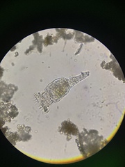 Philodina megalotrocha