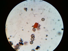 Physarum psittacinum