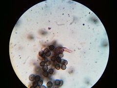 Physarum psittacinum