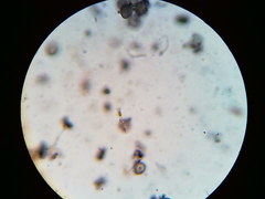 Physarum psittacinum