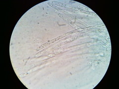Hypomyces tremellicola