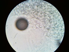 Hypomyces tremellicola