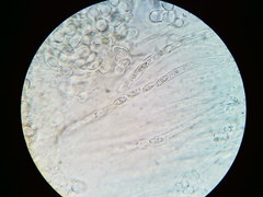 Hypomyces tremellicola