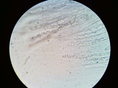 Hypomyces tremellicola