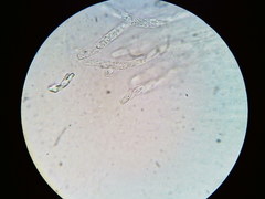 Hypomyces tremellicola