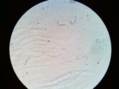 Hypomyces tremellicola