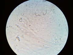 Hypomyces tremellicola