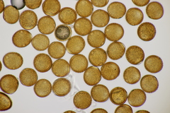 Puccinia calcitrapae