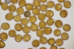 Puccinia calcitrapae