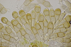 Puccinia cnici-oleracei