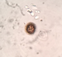 Strobilomyces confusus