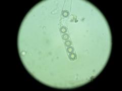 Octospora tuberculata