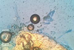 Pseudoidium neolycopersici