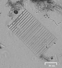 Fragilaria