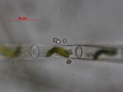 Chytridiomycota
