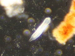 Gastrotricha