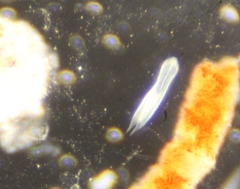 Gastrotricha