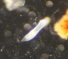 Gastrotricha