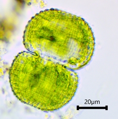 Cosmarium scrobiculosum